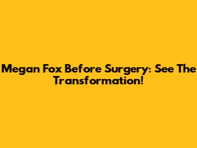 Megan Fox Before Surgery: See The Transformation!