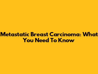 Metastatic Breast Carcinoma: What You Need To Know