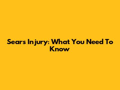 Sears Injury: What You Need To Know